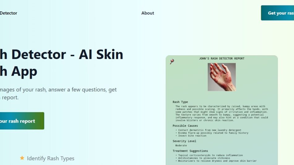 RashDetector
